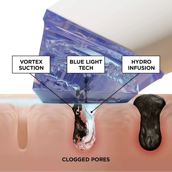 GLOfacial Hydro-Infusion Pore Cleansing + Blue LED Clarifying Tool🌺$199 MRSP - Picture 5 of 8